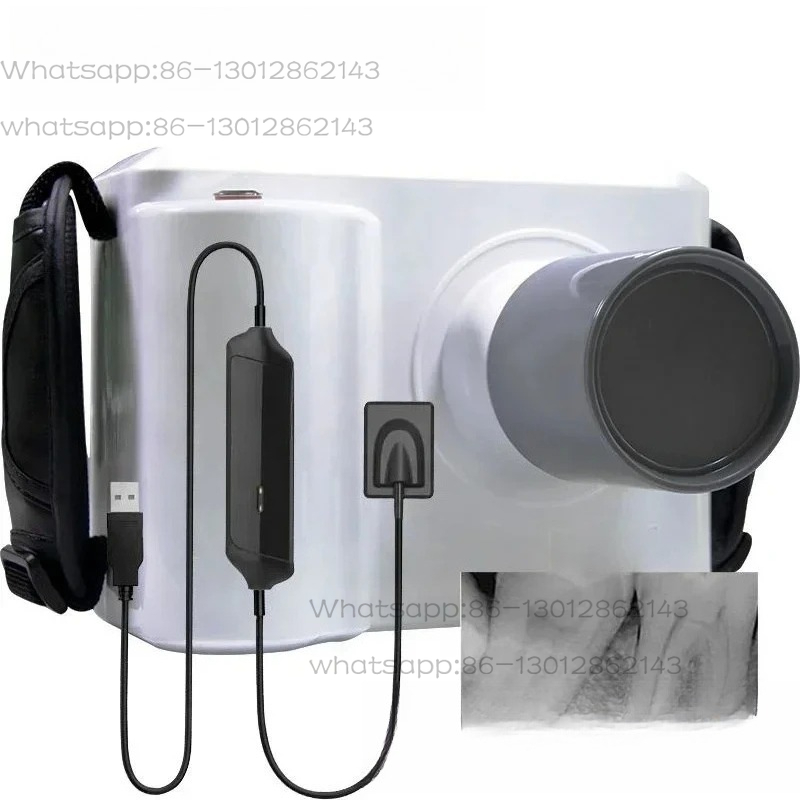 Full Set Portable Dental X ray - Veterinary X-Ray review and price