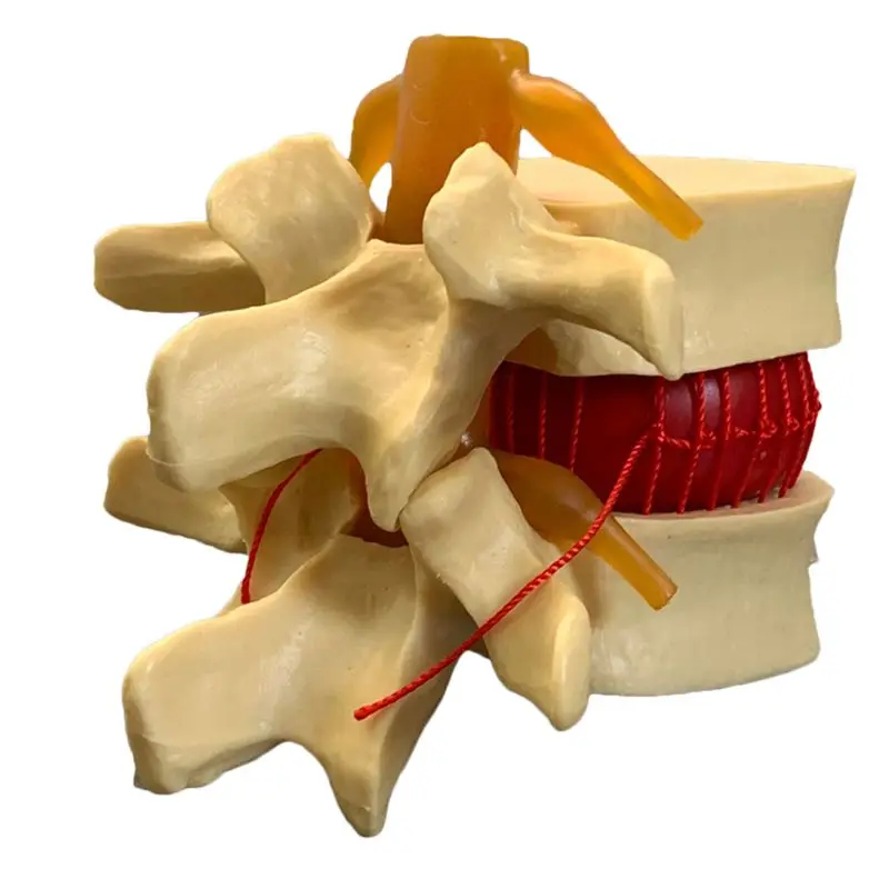 Anatomical Human Lumbar Verteb - Examination Bed Medical review and price