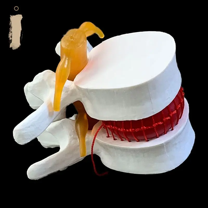 Anatomical Human Lumbar Verteb - Examination Bed Medical review and price