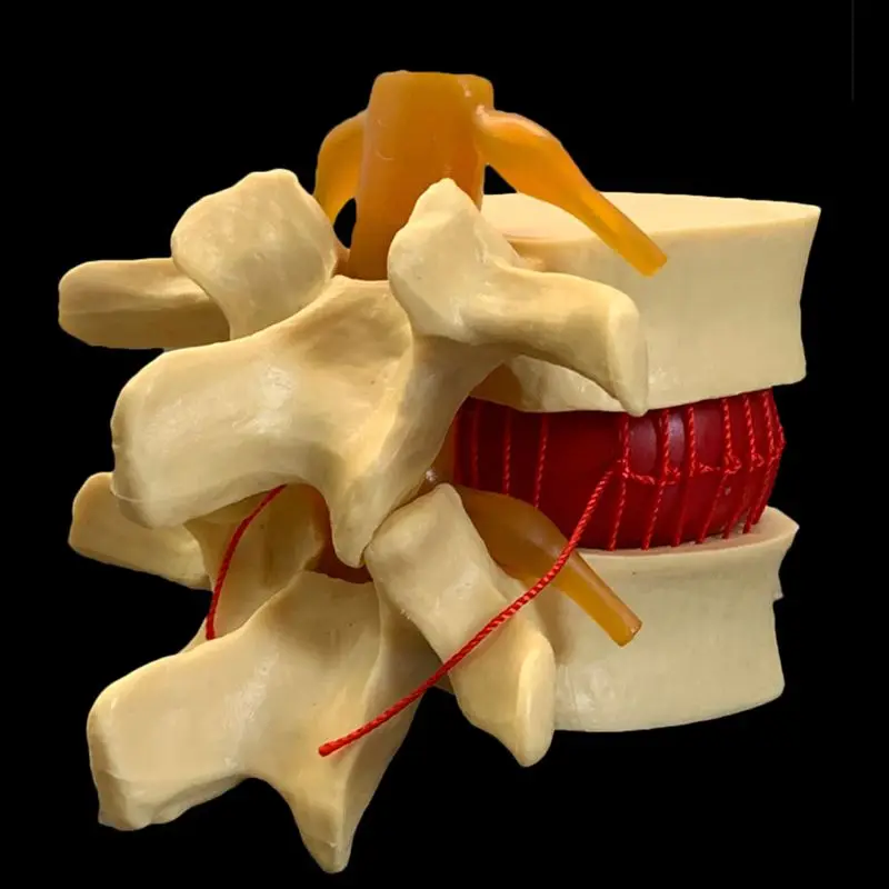 Anatomical Human Lumbar Verteb - Examination Bed Medical review and price