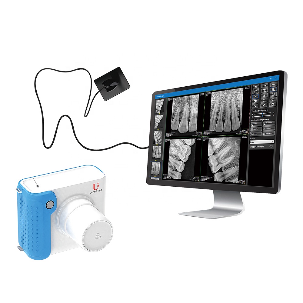 Photon-Counting Dental-Veterin - Veterinary X-Ray review and price