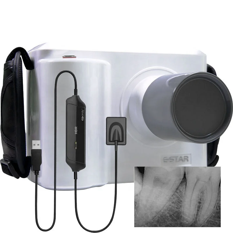 Full Set Portable Dental X ray - Veterinary X-Ray review and price