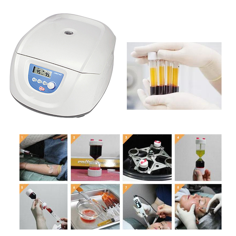 Best Seller Medical Blood PRP  - Medical Lab Center review and price